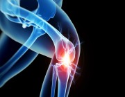 علاج ألم خلف الركبة