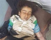 قتلها والدها.. ما قصة الطفلة اليمنية “أصيلة” التي تصدرت الترند مجددًا خلال الساعات الماضية؟