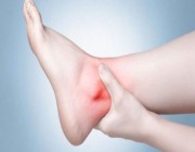 6 علامات على الساق تشير إلى إصابتك بجلطة دموية