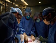 المريضة كانت ميتة دماغيا.. جراحون أمريكيون ينجحون في زراعة كلية خنزير في جسم إنسان