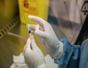 شفاء أول امرأة من الفيروس المسبب للإيدز بعد زارعة خلايا جذعية