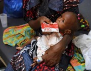 “اليونيسف” تحذر من تعرض 8 ملايين طفل في 15 دولة لخطر الموت من الهزال الحاد