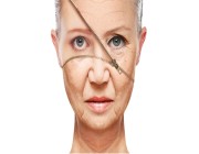 ما هي أسباب ظهور علامات الشيخوخة؟ طبيبة تجميل تُجيب