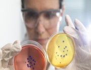 العلماء يكتشفون نشاطا غير متوقع في بكتيريا “ميتة”