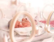 تدخل جراحي ينقذ حياة طفلة حديثة الولادة في نجران