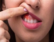 أخصائي يوضح لـ”أخبار24″ سبب زيادة آلام الأسنان في رمضان