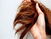 دراسة جديدة تربط بين حالة الشعر والإصابة بالنوبات القلبية