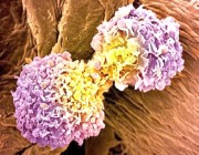 عقار يساعد في القضاء على سرطان الثدي