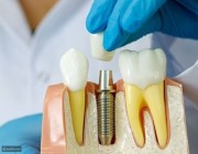 مبتعث يفوز بأفضل جائزة بأمريكا حول علاج للأسنان