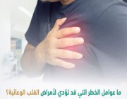 منها التدخين.. 7 عوامل قد تؤدي لأمراض القلب الوعائية تبرزها “سعود الطبية”