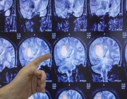 لقاح جديد لسرطان “الدماغ”