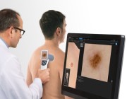 “فيكترا 360” لتشخيص سرطان الجلد بالذكاء الاصطناعي