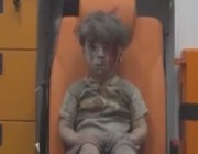 هل تذكرون الطفل عمران ذو الـ5سنوات والذي كاد أن يموت بسبب قصف قوات الأسد.. شاهده الأن