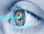 استشارية جراحة عيون تحذر من تصحيح النظر بالليزر دون التأكد من 4 معايير صحية