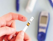 تطوير اختبار دم يساعد في تشخيص «الزهايمر»