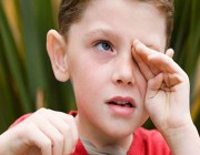 استشاري عيون: “الرمد الربيعي” مرض موسمي يصيب الأطفال والصبية.. وهذه أعراضه (فيديو)