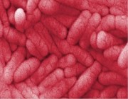 علماء: السالمونيلا تتحول إلى بكتيريا مقاومة للمضادات الحيوية