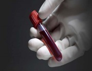 تعرَّف على فصيلة الدم الأكثر مقاومة للسرطان