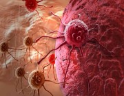 دراسة: ابتكار طريقة تجبر الأورام السرطانية على تدمير نفسها‎