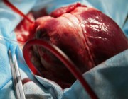 انفراجة طبية ستنقذ حياة آلاف من مرضى القلب