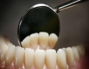 “لا حشو أسنان بعد اليوم”.. الطب الصيني يقدم الحل