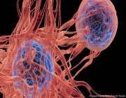 دراسة تربط بين علاجات “سن اليأس” وخطر السرطان