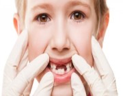 نصائح مهمة لحماية أسنان أطفالك من التسوس