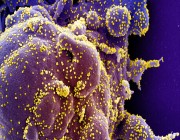 الصحة العالمية تعلن توقعاتها حول موعد الحصول على لقاح ناجح ضد فيروس كورونا