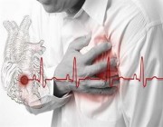“استشاري” يكشف عن أهم أسباب حدوث جلطة القلب الحادة وكيف يمكن تفاديها (فيديو)