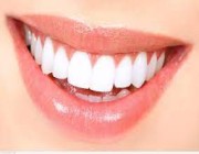 الصحة تحذر من مادة كارثية يستخدمها البعض في تبييض الأسنان