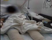 محكمة بمكة تصدر حكمها بحق الشاب ضحية حـادث الدهس بحي الشوقية