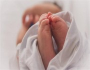 ولادة ناجحة لسيدة بلغ وزنها 176 كجم بمستشفى أبو عريش