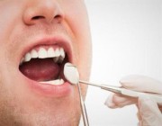 كيف يؤثر التدخين على الفم والأسنان؟ “الصحة” توضح