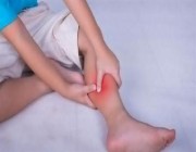 “سعود الطبية”: آلام الساق قد تنذر بمشكلات صحية خطيرة‏