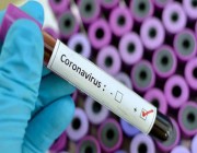 إجراء أكثر من 28 مليون مسحة PCR بالمملكة منذ أول إصابة بكورونا