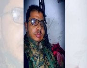 مقتل القيادي محمد حسين الحوثي في غارة جوية بمأرب
