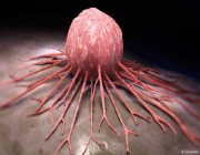 اكتشاف علاج جديد للسرطان.. يُقلص الأورام ويمنح أملاً للمرضى الميؤوس من شفائهم