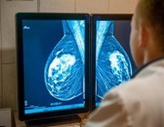 هل يتسبب جهاز الكشف عن سرطان الثدي في الإصابة بالمرض؟ “الصحة” تجيب