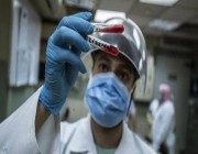 مصر تسجل 881 إصابة جديدة بفيروس كورونا