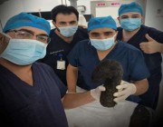 عملية نادرة.. فريق طبي يستخرج 6 كيلو “شعر” من بطن فتاة عشرينية