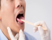 علامات في تجويف الفم والحلق تشير إلى الإصابة بأمراض خطيرة
