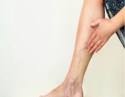 أعراض في الساق تدل على الإصابة بسرطان البنكرياس