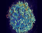 علاج لـ”الإيدز”.. علماء يتوصلون للأسرار المناعية لمرضى قضوا على “نقص المناعة” بلا دواء