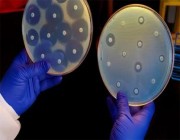 دراسة: أكثر من 1.2 مليون وفاة نتيجة عدوى ببكتيريا مقاومة للأدوية