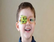 “تخصصي العيون” يوضح الطريقة الصحيحة للتعامل مع الطفل المصاب بكسل العين