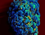 دواء للسرطان يمنح الأمل في هزيمة فيروس فقدان المناعة.. ما القصة؟