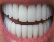 القطاع الصحي بظهران الجنوب ينفِّذ فعالية صحة الفم والأسنان