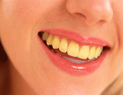 اصفرار الأسنان.. 6 أسباب غير مألوفة وهذه طرق تجنبها