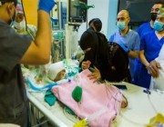 قائد الفريق الجراحي: حالة الطفل السيامي اليمني يوسف بدأت في التحسن بعد العملية