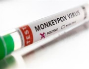 “روش” السويسرية تطور 3 اختبارات للكشف عن فيروس جدري القرود